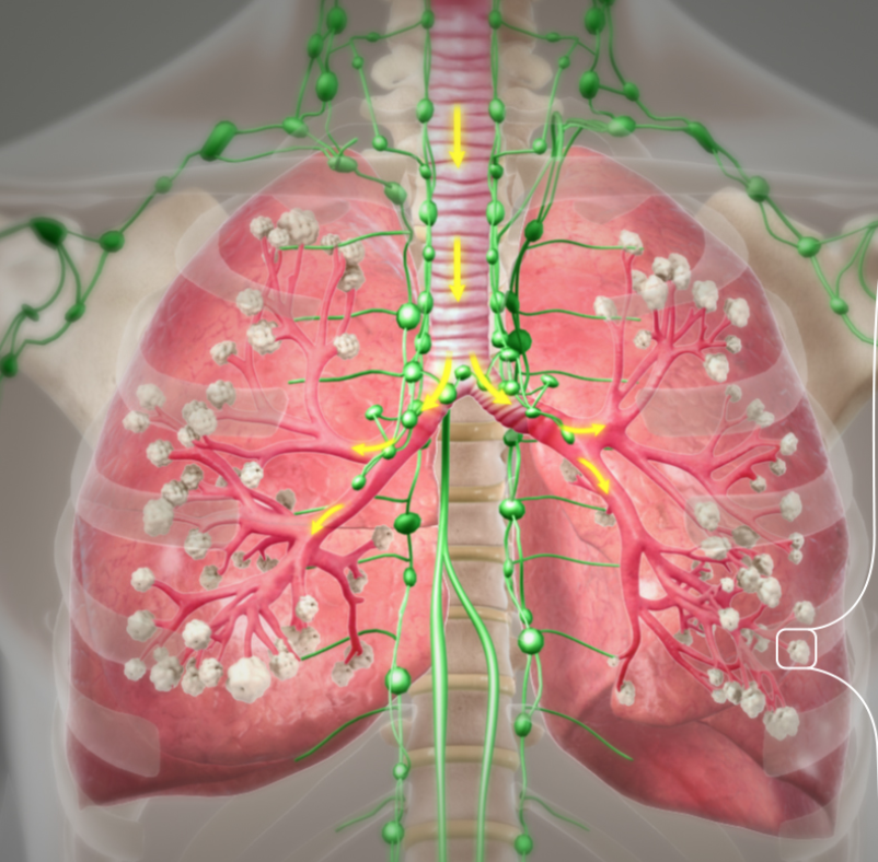Die Lunge | Anatomie und Funktion